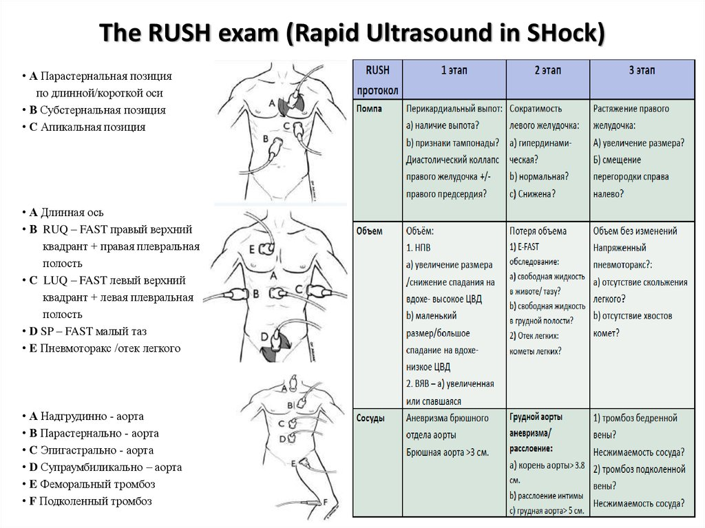 POCUS-протоколы: принципы, основные варианты и клиническое применение